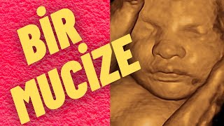 Download lagu Bir Mucizeye Tanık Olun Hafta Hafta Bebek Gelişimi Bir Mucizeye Tanık Olun Hafta Hafta Bebek Gelişimi