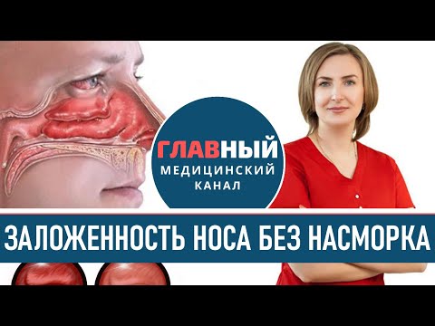 Вазомоторный Ринит. Заложенность Носа без насморка. Хронический ринит и гайморит