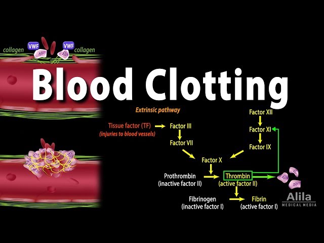 Hemostasis: Stages and How the Process Stops Blood Flow