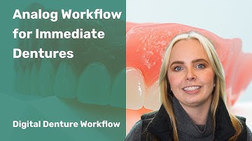 Digital Denture Workflow: Analog Workflow for Immediate Dentures