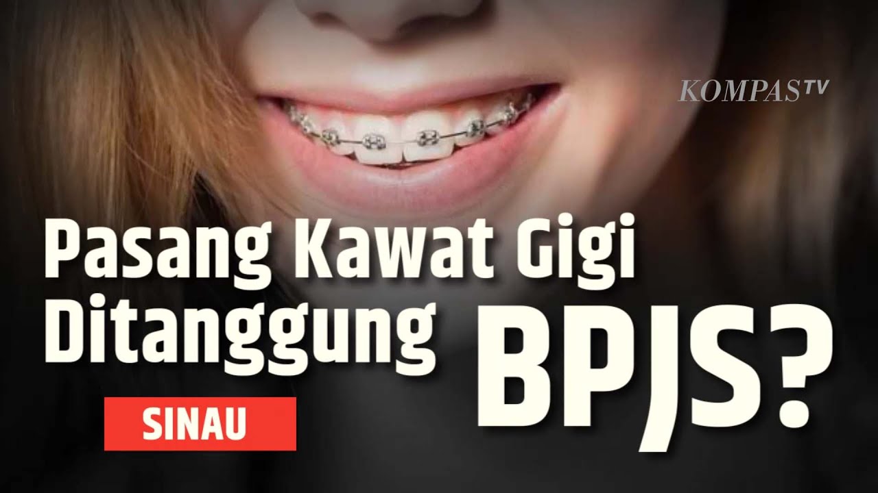 Pasang Kawat Gigi Apakah Ditanggung BPJS Kesehatan? SINAU YouTube Pasang Kawat Gigi Apakah Ditanggung BPJS Kesehatan? SINAU YouTube