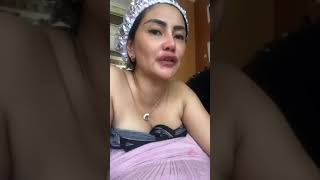 Tante siscamellyana jerawatan