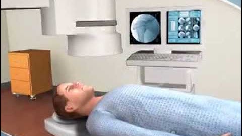 What to Expect during an Arthrogram procedure at CDI