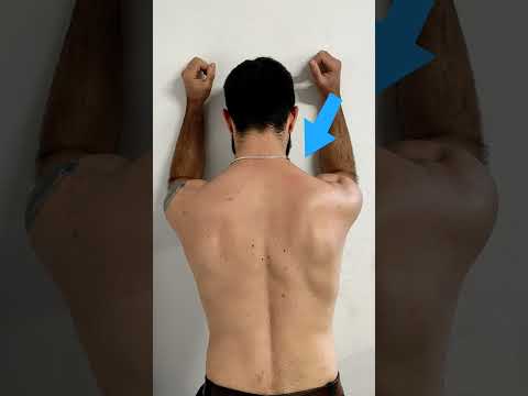 Video: Šta uzrokuje masnu grbu između ramena?