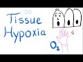 Tissue Hypoxia | Physiology | Pulmonary Medicine