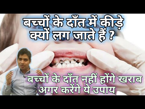 वीडियो: छोटे बच्चे के दांत क्यों खराब हो जाते हैं?