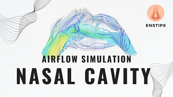 Airflow simulation of my nasal cavity - Empty Nose Syndrome case