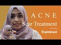 How to remove acne scars  by dermatologist dr ayesha faizan  nagpur