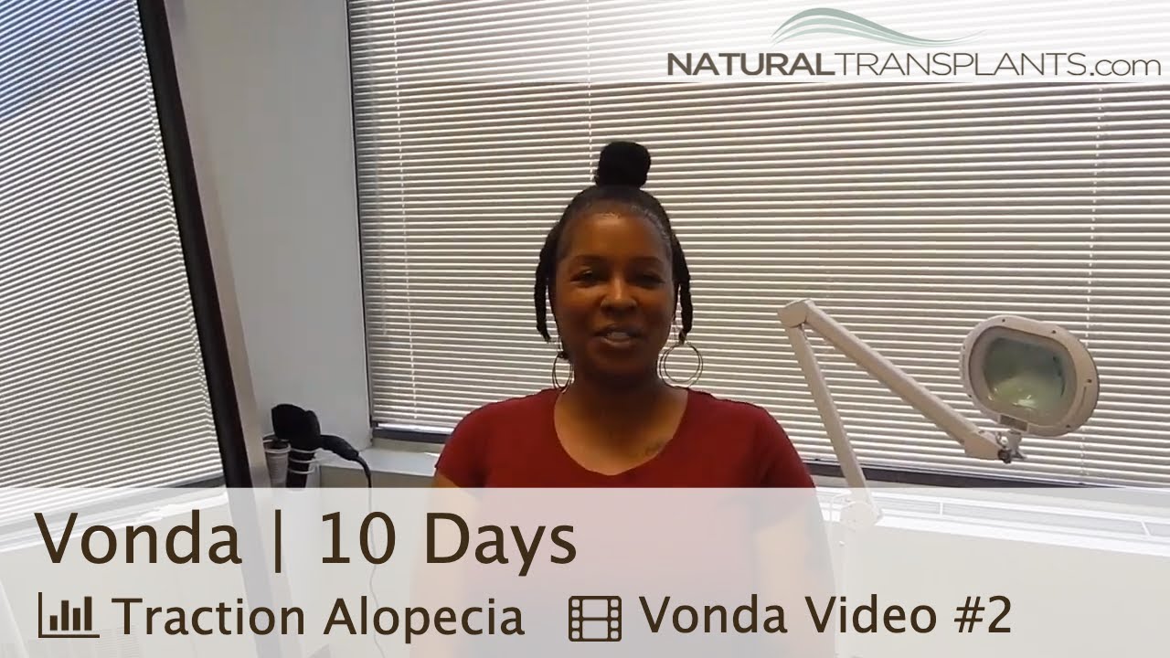 fue hair transplant month by month Hair Transplant Scar & Suture Removal | Traction Alopecia (Vonda)