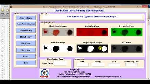 Blood Group Detection using Neural Network Matlab Project Code