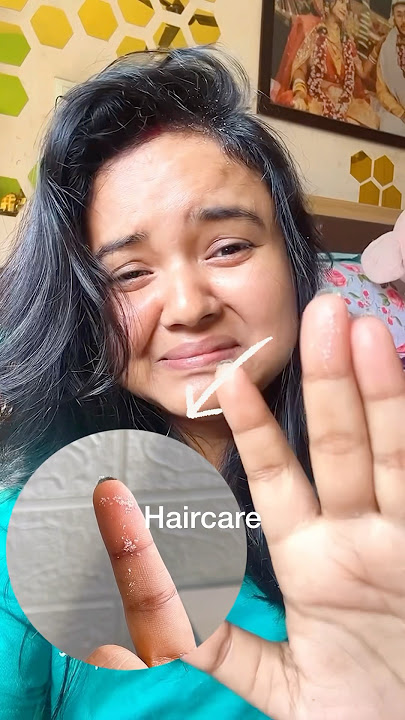 Best anti dandruff shampoo #haircare #ashortaday #skincare #ytshorts #ashortaday