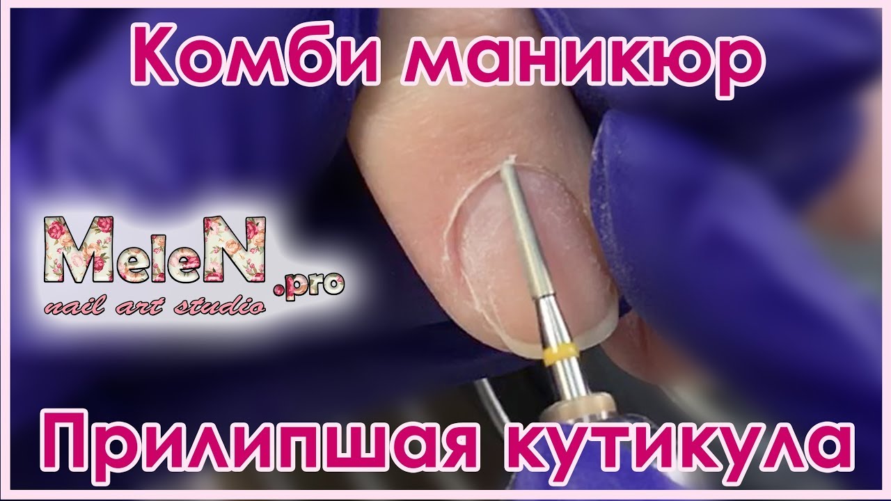 Комбинированный маникюр. Прилипшая кутикула. Мастер класс. Простые вензеля.