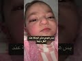 من النادر ظهور الأنياب قبل الاسنان الامامية ولكن لا داعي للقلق لو حصل هذا 