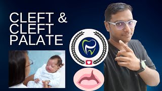 Dr Rudra Mohan | Understand The Problem of Clef  Lip  and Cleft Palate : Unravelling health concerns