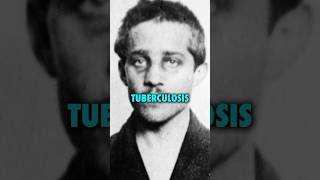 Tuberculosis caused World War I ! #ninjasarebutterflies #podcast ￼