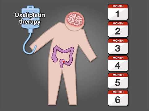 Review Sakit Sendi Selepas Chemotherapy