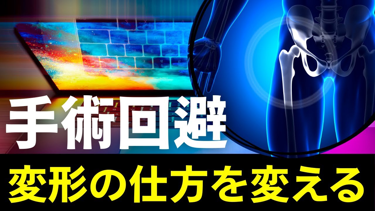 変形した股関節。手術しない裏技はないんですか？