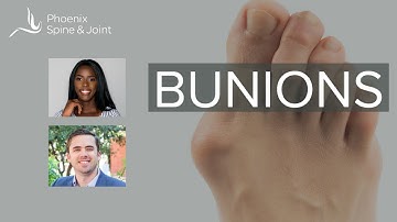 How long after bunion correction does it take to walk without pain?