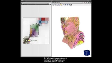 Volume Analysis Using Multimodal Surface Similarity