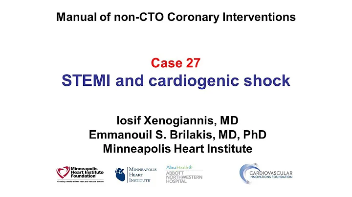 Case 27: PCI Manual: STEMI and shock