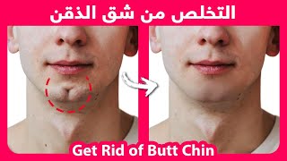 Get Rid of Butt Chin at Home - Fix Cleft Chin Naturally | إصلاح شق الذقن بشكل طبيعي