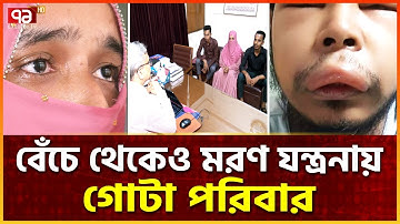 বাংলাদেশে বিরল রোগ, নেই কোন চিকিৎসা | Hereditary Angioedema | Ekattor Special