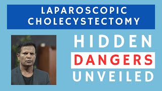 Colecistectomia Laparoscópica - Perigos Ocultos Revelados: A Anatomia Além da Lente