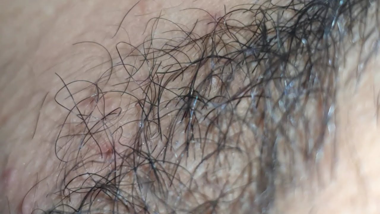 Beard hair MASSAGE THERAPY ASMR SATISFYING 