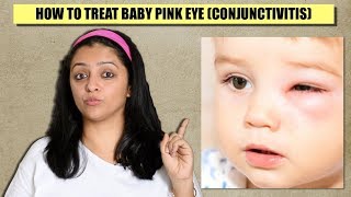 Treatment For Bacterial Conjunctivitis