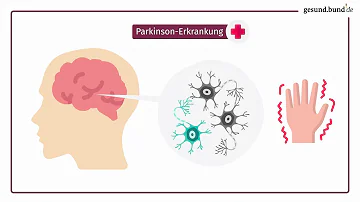 Was ist das Wichtigste bei Parkinson?