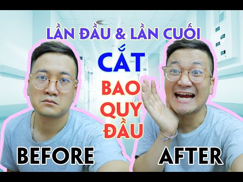 Danh Tuyên | Cắt bao quy đầu ở tuổi 23 - Kỷ niệm nhớ đời!