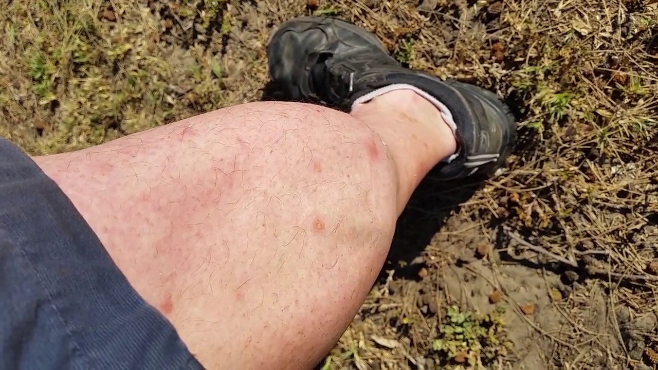 Super Leg Cramp while Cycling YouTube