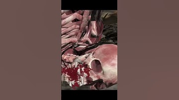 рентген Смоука #мкмобайл