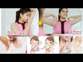 4 Underarms Hacks!গরমে মাত্র একদিনেই করেনিন সুগন্ধি আন্ডারআর্ম