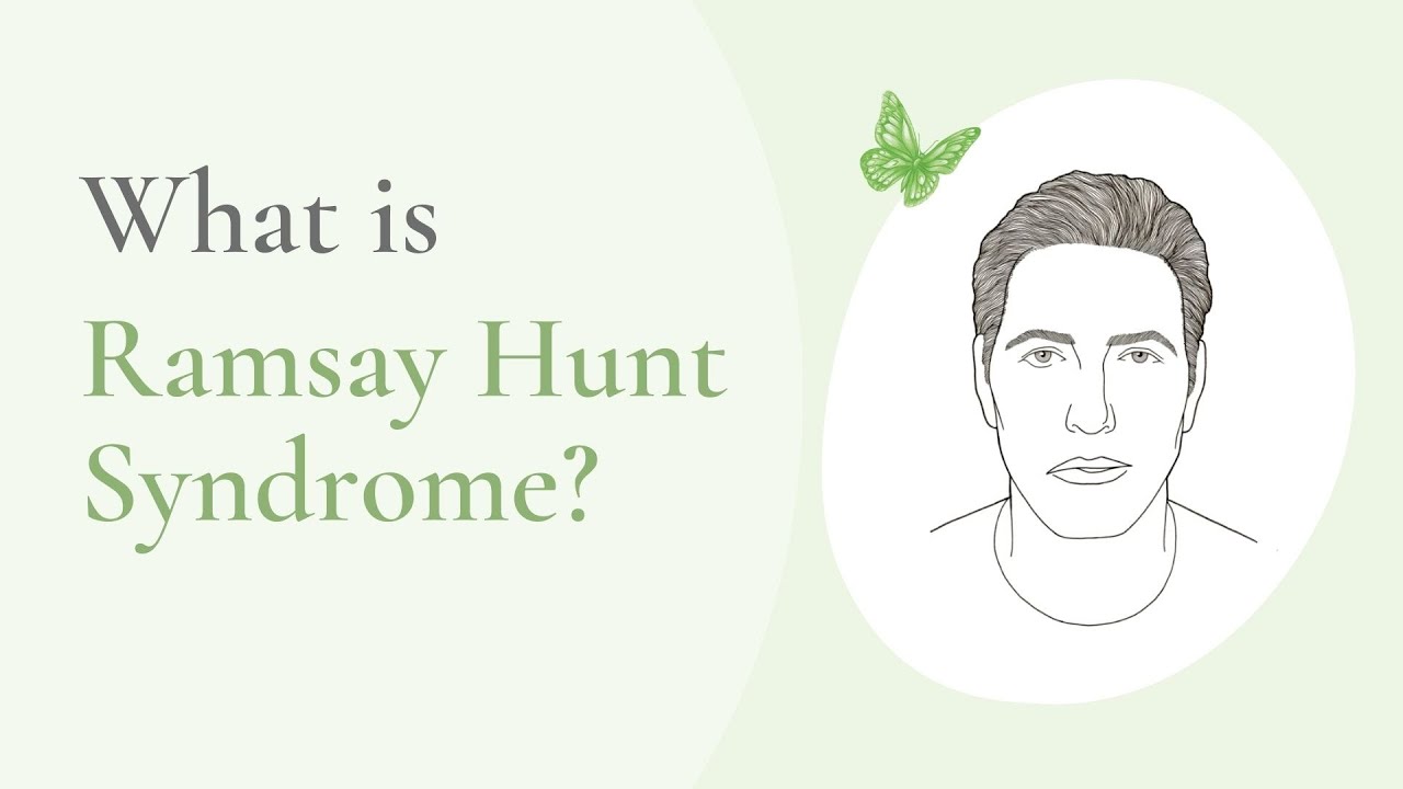 What Is Ramsay Hunt Syndrome YouTube What is ramsay hunt syndrome youtube
