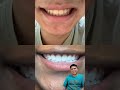 Abcd smile dentist thebest4 satisfying lips teethwhitening skincare makeup beauty