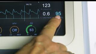 Control Automático de la FiO2 con Oxygenie de SLE6000