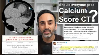 Calcium Score CT: Misconceptions, Who should get one, Risks, and Hype vs Reality
