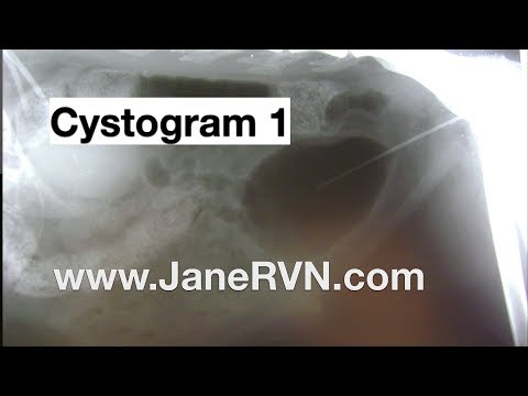 #planetrvn #OSCEtips #imaging cystogram