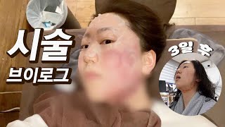 Radical Skin Treatment VLOG || Inmode, and my Family's Reaction? Hair Volume, Cooking, and Baby