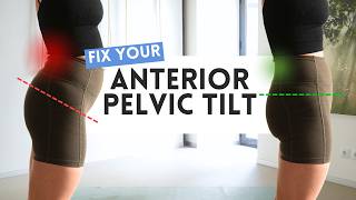 20-Min Strength + Stretch to Fix Anterior Pelvic Tilt (Relieve Back Pain &amp; Improve Posture)