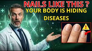 VERTICAL RIDGES on Your Nails After 60: What Your Body May Be Lacking — And Almost Nobody Explains
