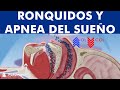 Apnea del sueño y Roncopatía ©