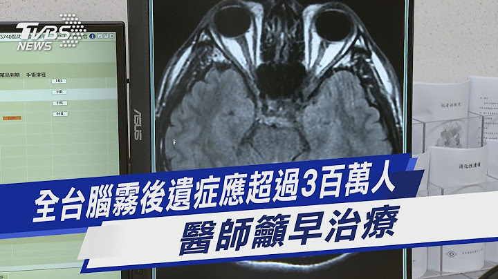 全台脑雾后遗症应超过3百万人 医师吁早治疗｜TVBS新闻 @TVBSNEWS01 - 天天要闻