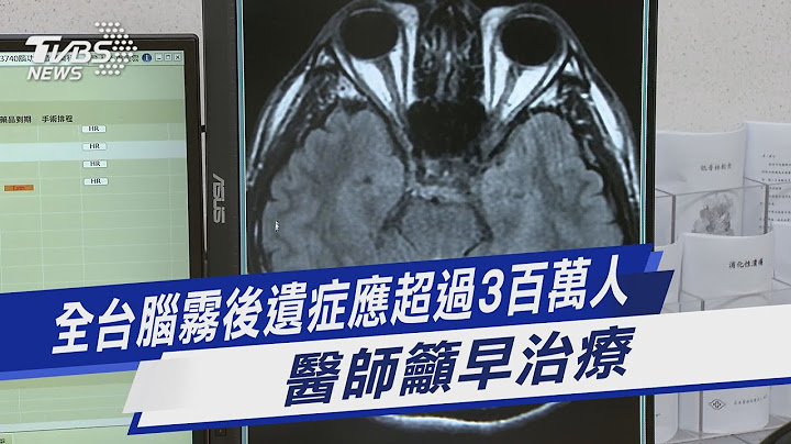 全台腦霧後遺症應超過3百萬人 醫師籲早治療｜TVBS新聞 @TVBSNEWS01 - 天天要聞