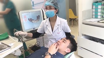 Scan mẫu răng bằng máy Itero - Niềng răng trong suốt Invisalign