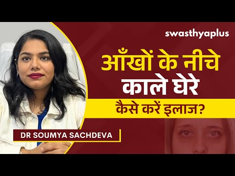 आँखों के नीचे काले घेरे: कैसे करें इलाज? | Dark Circles: How to Remove? in Hindi |Dr Soumya Sachdeva