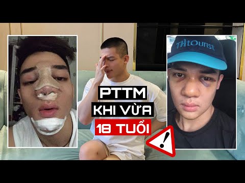 MŨI MÌNH ĐANG BỊ TUỘT SÓNG ? Tâm Sự Về Lần Đầu Đau Như “Chết Đi Sống Lại" - Kinh nghiệm sửa mũi!!!