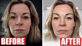 The best anti-aging device of all time! See how influencer lighting transforms skin and teeth by The Honest Channel 16,011 views 2 weeks ago 13 minutes, 30 seconds